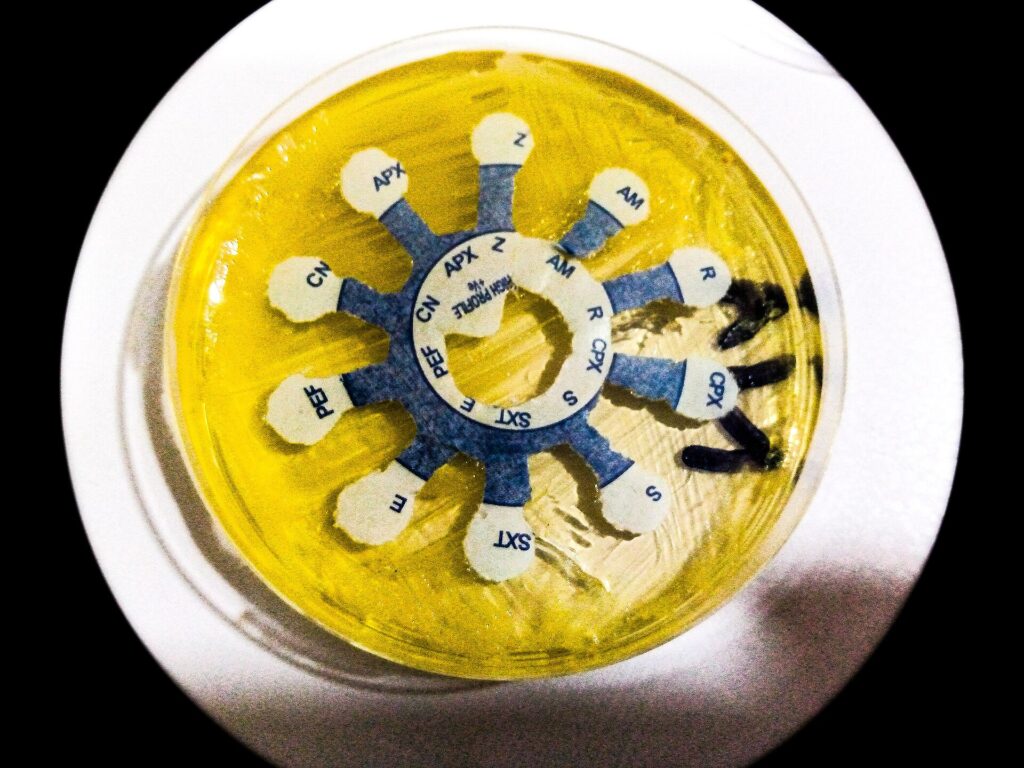 A scientist examining bacterial cultures in a laboratory